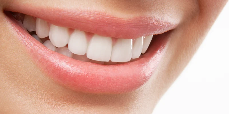 teeth white affiliate site template